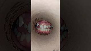 What Your SMILE Reveals About Your Oral Health 😃🦷 [upl. by Enaujed872]