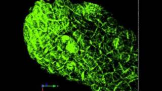 Microtubule dynamics in an Arabidopsis leaf [upl. by Jena]