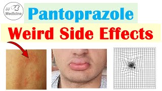 Pantoprazole Weird Side Effects Skin Infections Nutrient Deficiencies amp Why They Occur [upl. by Stephan]