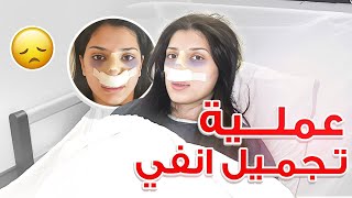 عملت عملية تجميل انفي بتركيا 👃🏻🏥 [upl. by Enilrac101]