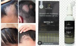 BACKHA R F Topical Solution Minoxidil with Finasteride Topical Solution USP 5 [upl. by Innavoij]