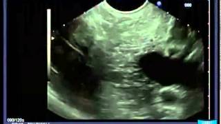 Longitudinal EUS Anatomical Guiding Structures in the Upper Abdomen Cranial  Right [upl. by Aleak569]