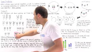 Down Syndrome Trisomy 21 and Translocation [upl. by Heiner]