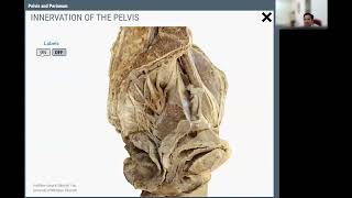 Anatomy of Pelvis [upl. by Ahseenal]