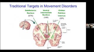 07 FUS and Advanced Therapies Kern Made with Clipchamp [upl. by Aurita]