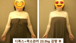 23키로감량 20키로감량 대성공다이어트 성공후기체지방줄이기 다이어트식단다이어트음식부유방다이어트다이어트후기다이어트전후디톡스다이어트20키로감량디톡스체지방감량 [upl. by Sadowski]