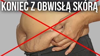 3 SPOSOBY NA OBWISŁĄ SKÓRĘ W CZASIE ODCHUDZANIA I CIĄŻY  JAK ZAPOBIEC SUPLEMENTY KOSMETYKI [upl. by Harcourt]