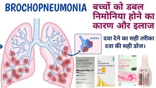 बच्चों में डबल निमोनिया होने का कारण और इलाज  Bronchopneumonia causes and treatment in Hindi [upl. by Assyn]