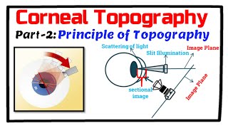 Corneal Topography Principles of VideokeratographyVKG Keratoscope amp Keratometer [upl. by Ennaear466]