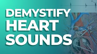 S1 S2 S3 and S4 Heart Sounds  MedStudys Heart Sounds [upl. by Lartnom]