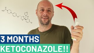 Ketoconazole Shampoo Experiment As Good As Minoxidil [upl. by Grimbly]