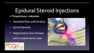 5 Things to Know About Epidural Steroid Injections 602 5076550 [upl. by Nohsed]