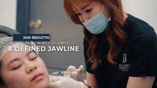 Jaw Reduction Botox  V Shape Face amp Jaw Slimming  Become Aesthetics Clinic Singapore [upl. by Macpherson]