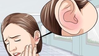 6 Remedios caseros para deshacerse de la otitis externa [upl. by Stambaugh]