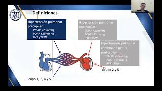 Diagnostico y tratamiento de la Hipertensión Arterial Pulmonar [upl. by Nomae]