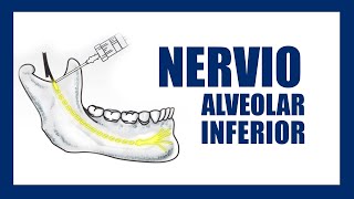 Tecnica de anestesia para el Nervio alveolar inferior [upl. by Anaidirib]