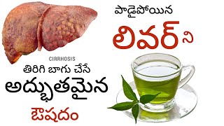 Cleanse Your Liver Naturally l jaundice jaundicetreatment phyllanthus hepatitis livercirrhosis [upl. by Ahsiloc]