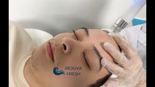 How to Do a Professional Facial Treatment w 3rd Gen 7 in 1 Professional Hydro Dermabrasion Machine [upl. by Danell153]