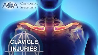 AOA Orthopedic Specialists  Clavicle Injuries [upl. by Neyut868]