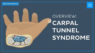 Carpal tunnel syndrome Symptoms causes treatment  Quick Anatomy  Kenhub [upl. by Erreit]