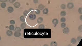 Reticulocyte under microscope [upl. by Dianemarie]