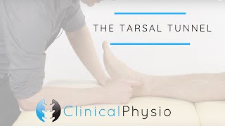 Tarsal Tunnel Test  Clinical Physio [upl. by Aicilihp620]