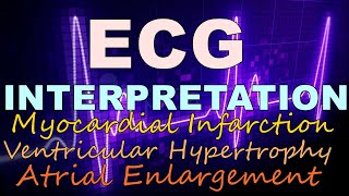 ECG INTERPRETATION  PART 2  MYOCARDIAL INFARCTION  VENTRICULAR HYPERTROPHY  ATRIAL ENLARGEMENT [upl. by Ofella]