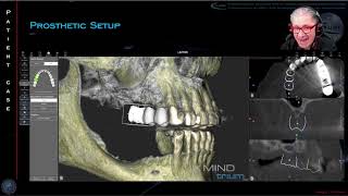 Contemporary Gold Standards in implantology workflow and augmentative surgery a critical review [upl. by Edmondo]