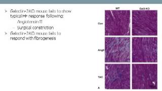 Galectin 3 Enabling a New Pharmaceutical Paradigm in Treatment f eart Failure [upl. by Roseanna329]