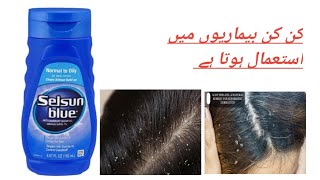 selsun blue shampoo uses complete review [upl. by Adnale646]