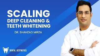 SCALING DEEP CLEANING amp TEETH WHITENING  Dr Shahzad Mirza [upl. by Nolham642]