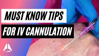 Important tips and tricks for IV cannulation [upl. by Stanley]