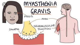 Role of Neostigmine in the treatment of Myasthenia Gravis [upl. by Auhsuj]