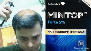 Mintop Forte 5 Minoxidil II Hair Regrowth Formula II Baldness cure II procapil amp Cococin [upl. by Oigolue741]