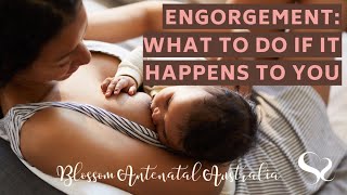 Engorgement What to do if it Happens to You [upl. by Kayne]