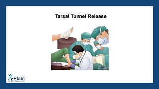 Tarsal Tunnel Release [upl. by Ahsieat935]