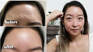 How I Cleared My Textured Skin and Bumps  Products and Ingredients for Smooth Skin [upl. by Prisca]