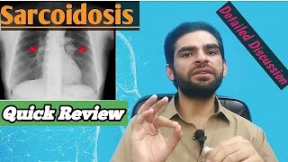 sarcoidosis in urdu hindi  signs amp symptoms investigations treatment [upl. by Puduns258]