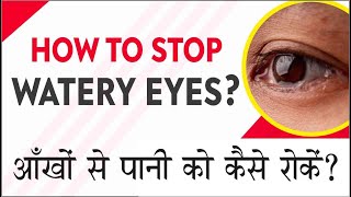 Best Treatment of Watery Eyes  Tear duct blockage problem amp Solutions आँखों से पानी को कैसे रोकें [upl. by Lindsay]