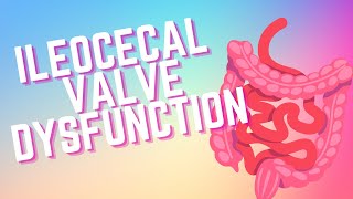 ILEOCECAL ICV VALVE DYSFUNCTION [upl. by Rafaelof376]