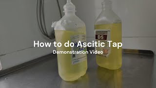 Paracentesis  How to perform Ascitic Tap [upl. by Orford]