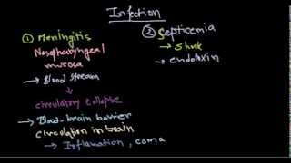 Neisseria meningitidis infection [upl. by Frayne]