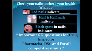 Check your nails to check your healthQuiz13Imp GK for DSC Pharmacist Drug Inspector amp all exams [upl. by Pasco960]