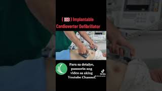 Implantable Cardioverter Defibrillator ICD [upl. by Alicec995]