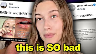 Hailey Bieber’s skincare ISN’T going well [upl. by Htiekram]