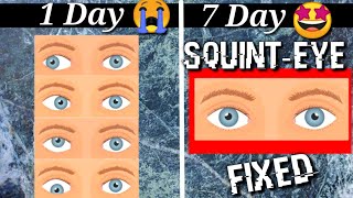 Fix Squint eye with EXERCISE at Home [upl. by Doane439]