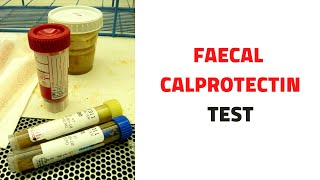 FECAL STOOL CALPROTECTIN TEST Uses Inflammatory Bowel Disease [upl. by Merralee]