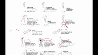 General principles of ortho trauma for PA students 1  basics [upl. by Adialeda]