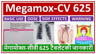 MegamoxCV 625 tablet मेगामोक्ससीवी 625 टैबलेट की जानकारी Use Daily Dose Side effects Warnings [upl. by Munt]