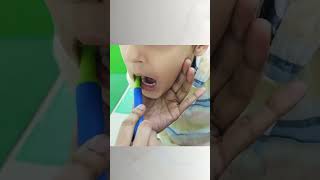 Oral Sensory Integration Therapy by Dr Inchie Lonial [upl. by Arikahc]